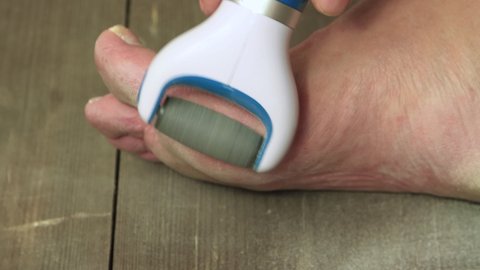 The hand cleans the corn on the leg with an electric roller file. We do the pedicure ourselves. Self care for feet, concept. Isolated video, close-up. Warm, soft light. UHD 4K.