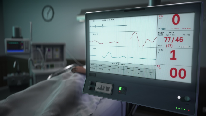 Identifying the rapid decline of the patients pulse in the emergency room. Monitoring system examines the patients pulse in the emergency room. Emergency patients heartbeat is slowing down. Pulse. Royalty-Free Stock Footage #1086822863