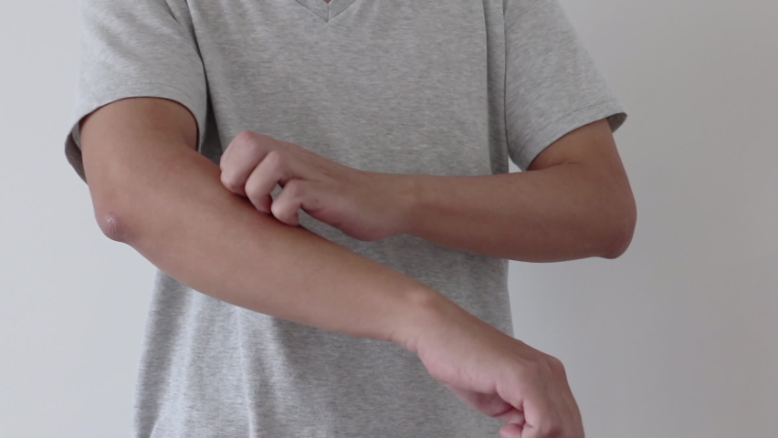 Young asian man itching and scratching on arm from itchy dry skin eczema dermatitis | Shutterstock HD Video #1086906530