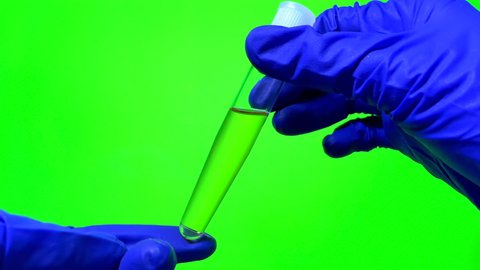Urine test in test tube on green screen background. Foam in urine. Male urine with small amount of protein and bilirubin. Risk of diseases developing.