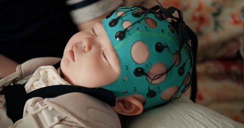 A hat with wires for a child. Analysis of the baby at home. Eeg of the brain of a newborn baby.