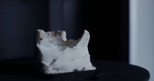 The orthodontist adds parts of the cast of the jaw by assembling the jaw structure on a plaster backing. Dental prosthetics, work on the creation of prostheses. Video in 4k, red komodo
