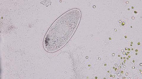 Paramecium caudatum is a genus of unicellular ciliated protozoan and Bacterium under the microscope.
