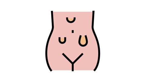 abdominal hernias disease color icon animation