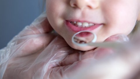 Oral Sore Stock Video Footage 4k And Hd Video Clips Shutterstock