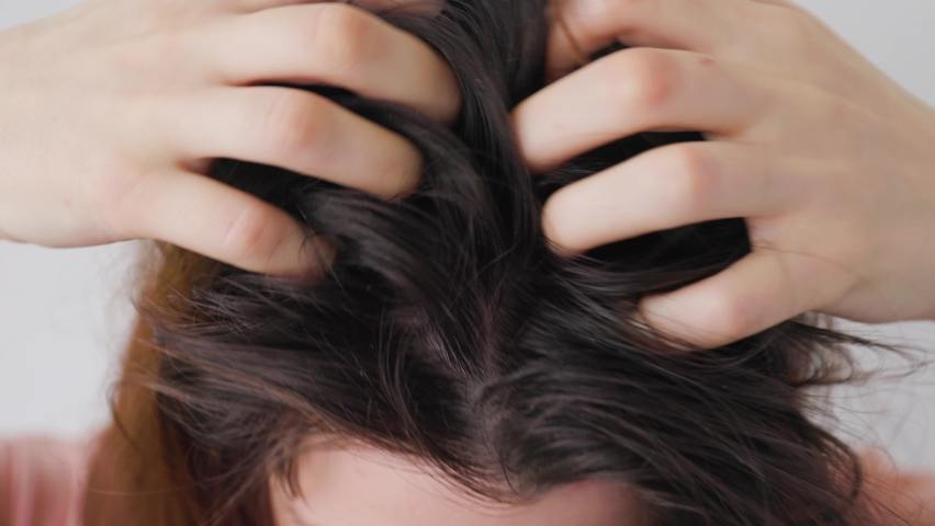 Close up of A woman strongly scratches her head with her hands. Dark hair with dandruff. Top view. The concept of diseases of the scalp Royalty-Free Stock Footage #1088115315