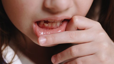 Child loosens his milk tooth. Cute little girl of 7-9 years old is losing milk teeth. Changing milk teeth to indigenous teeth. Children's dentistr. Toothpaste. Dentistry for children