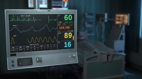 Electrocardiogram Device At Medical Hospital Shows Heart Rate Of Dying Patient. Device For Heart Rate Data Analysis Indicates Patient In Critical Condition. Device Monitoring Heart Rate Of Ill Patient