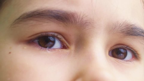 close-up of the brown eyes of the girl with a tear due to contact lenses. modern ophthalmic corrective agents for children. Safe wearing of lenses.
