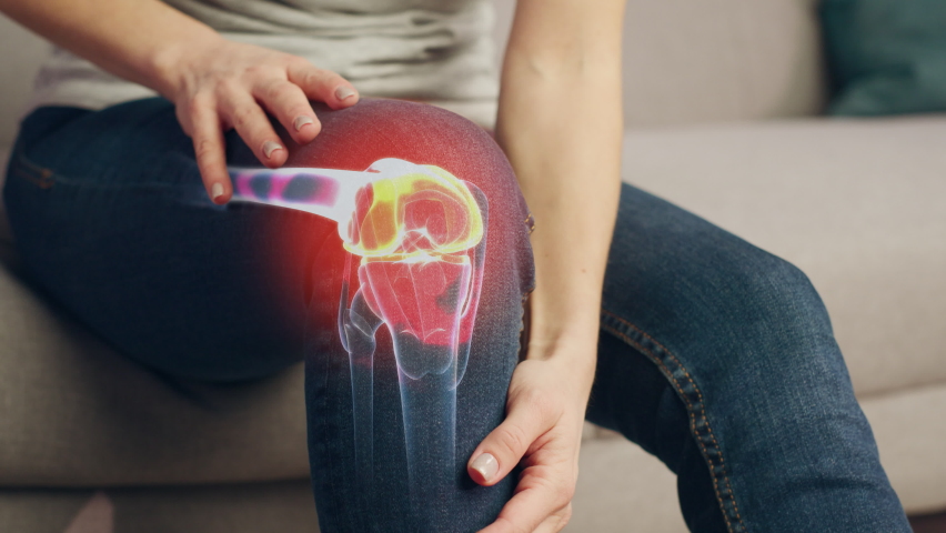 VFX Joint and Knee Pain Augmented Reality Animation. Close Up of a Person Experiencing Discomfort in a Result of Leg Trauma or Arthritis. Massaging the Muscles to Ease the Injury. Royalty-Free Stock Footage #1088284781