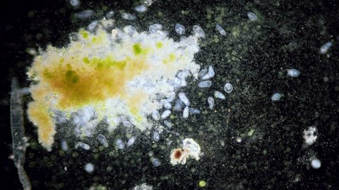 Paramecium high density population in microscope dark field