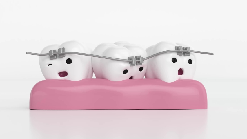 orthodontics with bracket, happy orthodontic teeth Royalty-Free Stock Footage #1088332505