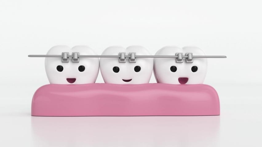 Orthodontics with bracket, happy orthodontic teeth | Shutterstock HD Video #1088332505