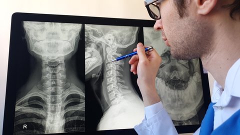 Doctor radiologist analyzing a cervical spine x-ray of a patient with spinal chronic pain.