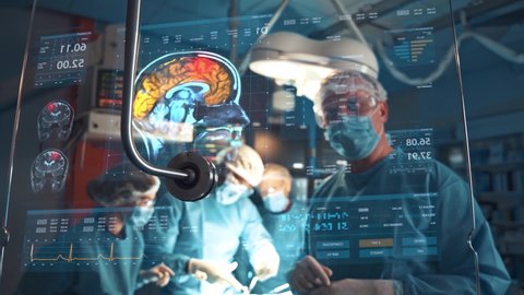 High tech hospital surgeons perform brain surgery using augmented reality display. Future advanced technology. Science futuristic digital concept. Doctor data, medical.の動画素材