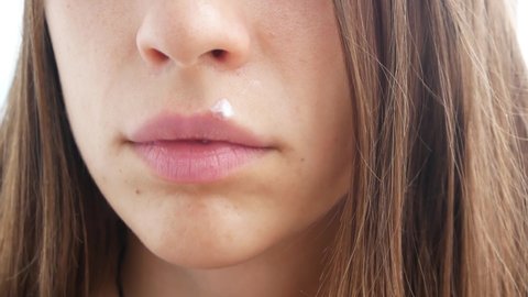A young lady smears herpes on her lip with cream close-up
