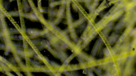 Micro organism - algae and ciliates