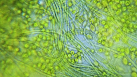 Cyanobacteria and green algaeement under microscope