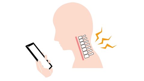 This is an animated video showing how a straight neck (smartphone neck) causes pain in the neck and shoulders.