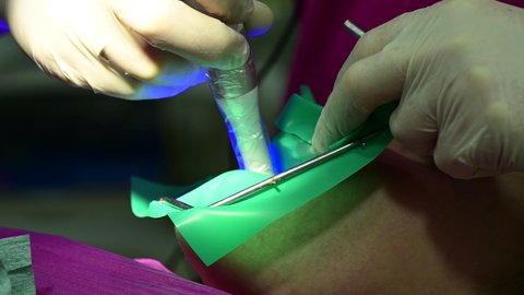 Dental ultraviolet and rubber dams are used by the dentist to treat teeth.