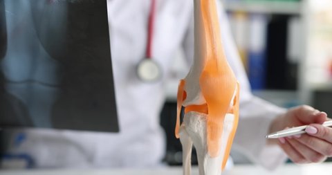 X-ray image and leg injury rheumatologist consultation