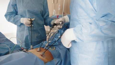 Operation using laparoscopic equipment. The surgeon's doing laparoscopic surgery in the operating room. Minimally invasive surgery. Surgeons team hands during laparoscopic abdominal operation.