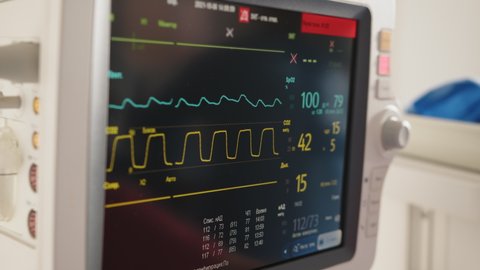Monitor vital signs for patient in hospital. Heart rate monitor in hospital theater. Medical vital signs monitor instrument in a hospital on anesthesia surgery monitor. ECG. Patient heartbeat.