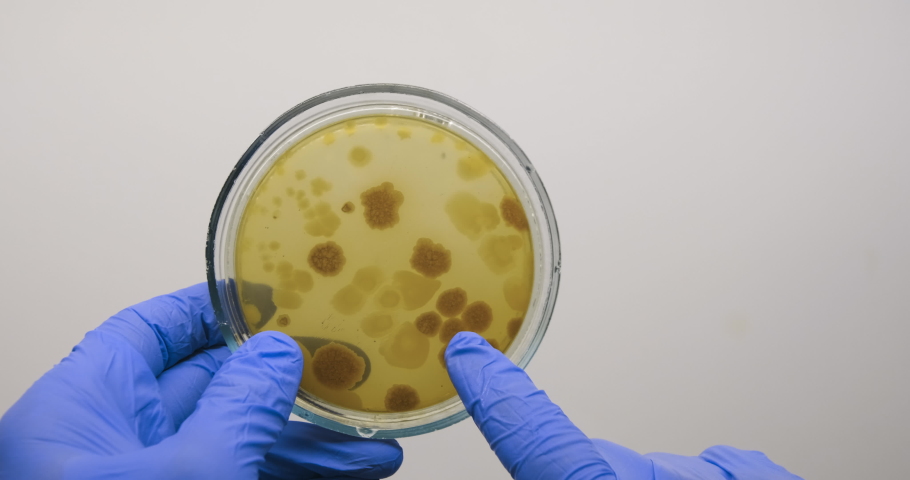 The scientist holds a petri dish with bacteria with two gloved hands and points his finger at the bacterial colonies.