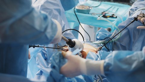 The surgeon's doing laparoscopic surgery in the operating room. Cancer tumor removal. Surgeons team hands during laparoscopic abdominal operation in child surgery. Tools for laparoscopic surgery