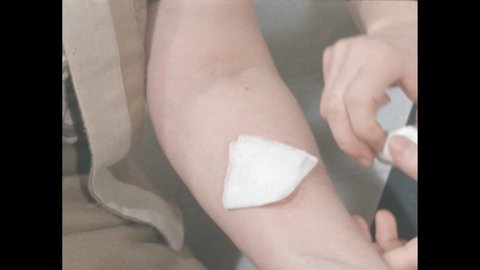 1960s: Nurse holds gauze with ointment on it, places gauze on woman's arm, bandages arm.