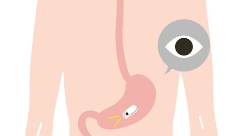 This is an animated video of a gastroscopy (capsule). Loopable