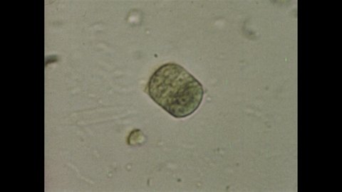 1970s: blue green algae under microscope. Single celled organism. Chlorophyl in blue green algae. Cell division in algae.