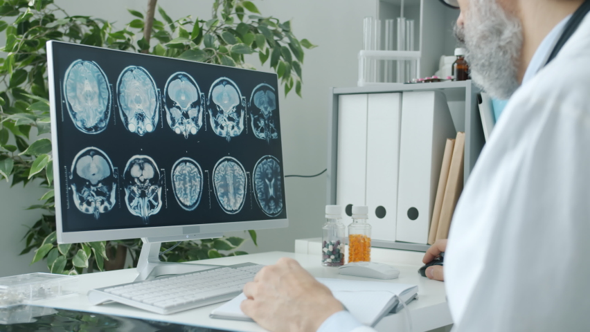 Doctor radiologist analyzing human skull images looking at computer screen and witing indoors in hospital. Modern technology and radiology concept. Royalty-Free Stock Footage #1089025339