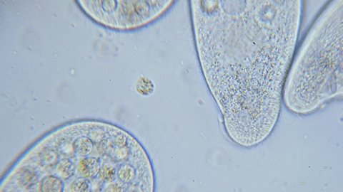 High density of unicellular paramecium protozoa under microscope