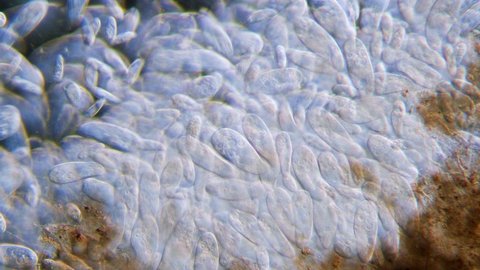 High density of unicellular paramecium protozoa under microscope