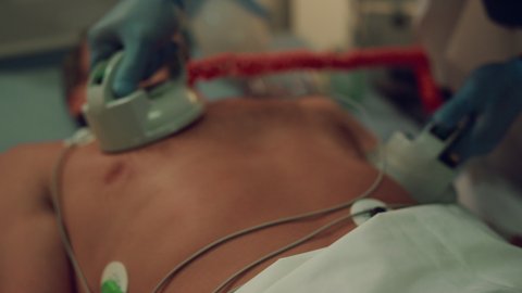 Medical worker hands defibrillating unconscious man in emergency room closeup. Unrecognized african american doctor saving dying male patient in hospital ward. Heart first aid in intensive care unit.