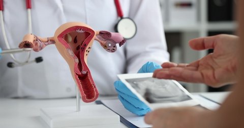 Gynecologist shows structure of uterus to patient in clinic