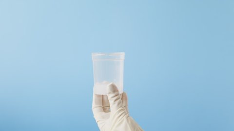Close up of doctor's hand in a white medical glove holds a jar of sperm for analysis and close a test tube. Blue background. The concept of sperm donation and impotence.