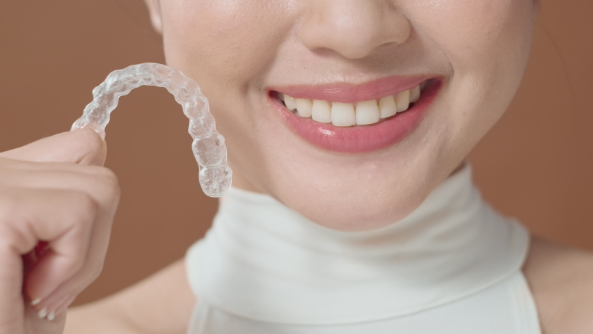 A young woman with beautiful teeth is holding Invisalign, healthy dental concept  | Shutterstock HD Video #1089478853