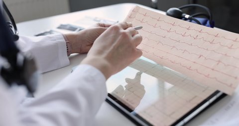 Doctor examines an electrocardiogram of patient after heart attack
