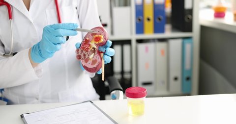 Educational model of human body of kidney in hands of doctor