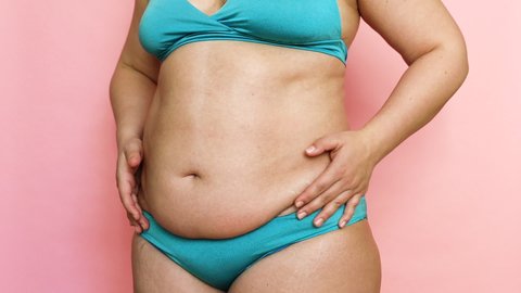 Closeup of overweight fat woman emphasizing excess adiposity, holding tummy flabs with obesity, excess fat in blue underwear. Dangling stomach. Go on unhealthy diet. Excess skin. Body mass index