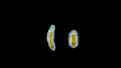 Polychaeta larva under microscope, family Dorvilleidae, possibly genus Ophryotrocha. Sample found in Red Sea