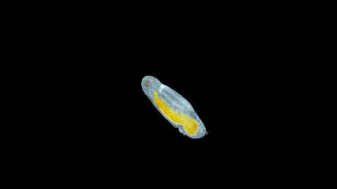 Polychaeta larva under microscope, family Dorvilleidae, possibly genus Ophryotrocha. Sample found in Red Sea