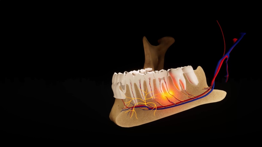 Toothache. Anatomical detailed section of the teeth. Nerve inflammation. 3D animation Royalty-Free Stock Footage #1089725109