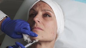 woman undergoing facial mesotherapy treatment with hyaluronic acid applied with a needle