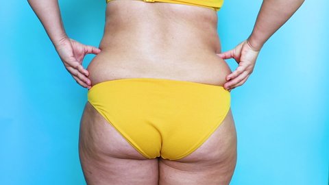 Back view of unrecognizable fat overweight woman wearing yellow bikini, squeezing, crumpling excess fat of waist on blue background. Body positive, massage, obesity, weight loss, liposuction, diet.