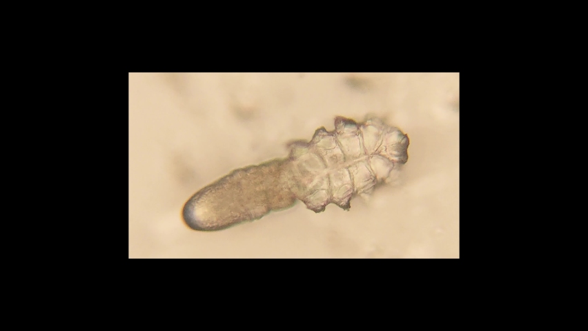 footage of Demodex or face mites
 under the microscope  Royalty-Free Stock Footage #1089863293