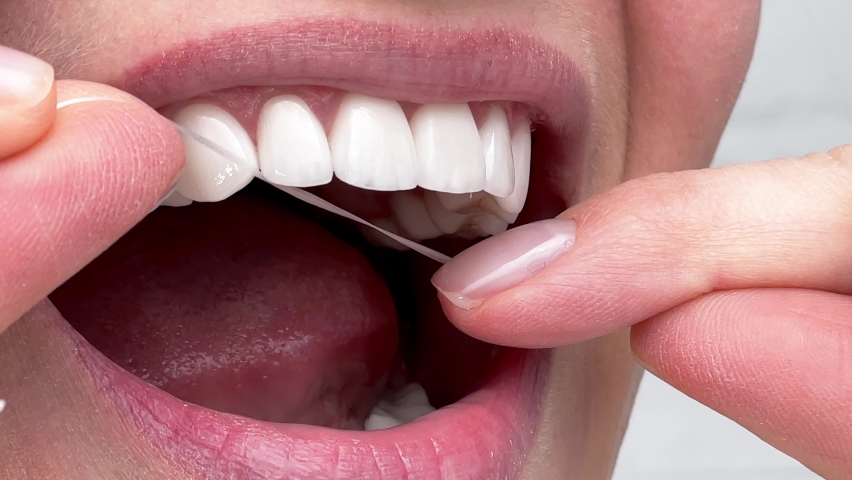 Closeup woman flossing perfect white teeth with floss toothcare hygiene, teeth cleaning routine and cavity prevention, female veneer smile, dental care and stomatology. | Shutterstock HD Video #1089870769