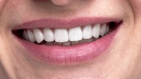 Perfect white teeth close up, female veneer smile, dental care and stomatology, dentistry - Powered by Shutterstock - Get 15% off with code: PIKWIZARD15